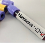 hantavirus-bir-salgina-donusur-mu.jpg