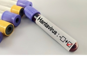 hantavirus-bir-salgina-donusur-mu.jpg
